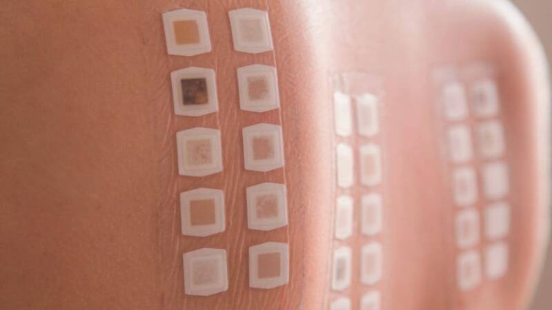 Patch Test 01